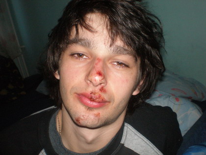 Mateusz Kowalski after Face Lifting